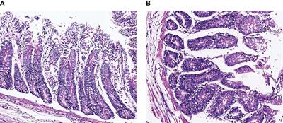 Effect of Early Pathogenic Escherichia coli Infection on the Intestinal Barrier and Immune Function in Newborn Calves